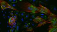 Exploring Genomic Basis for Neurologic and Cardiovascular Disease using Reprogramming and Pluripotent Stem Cells